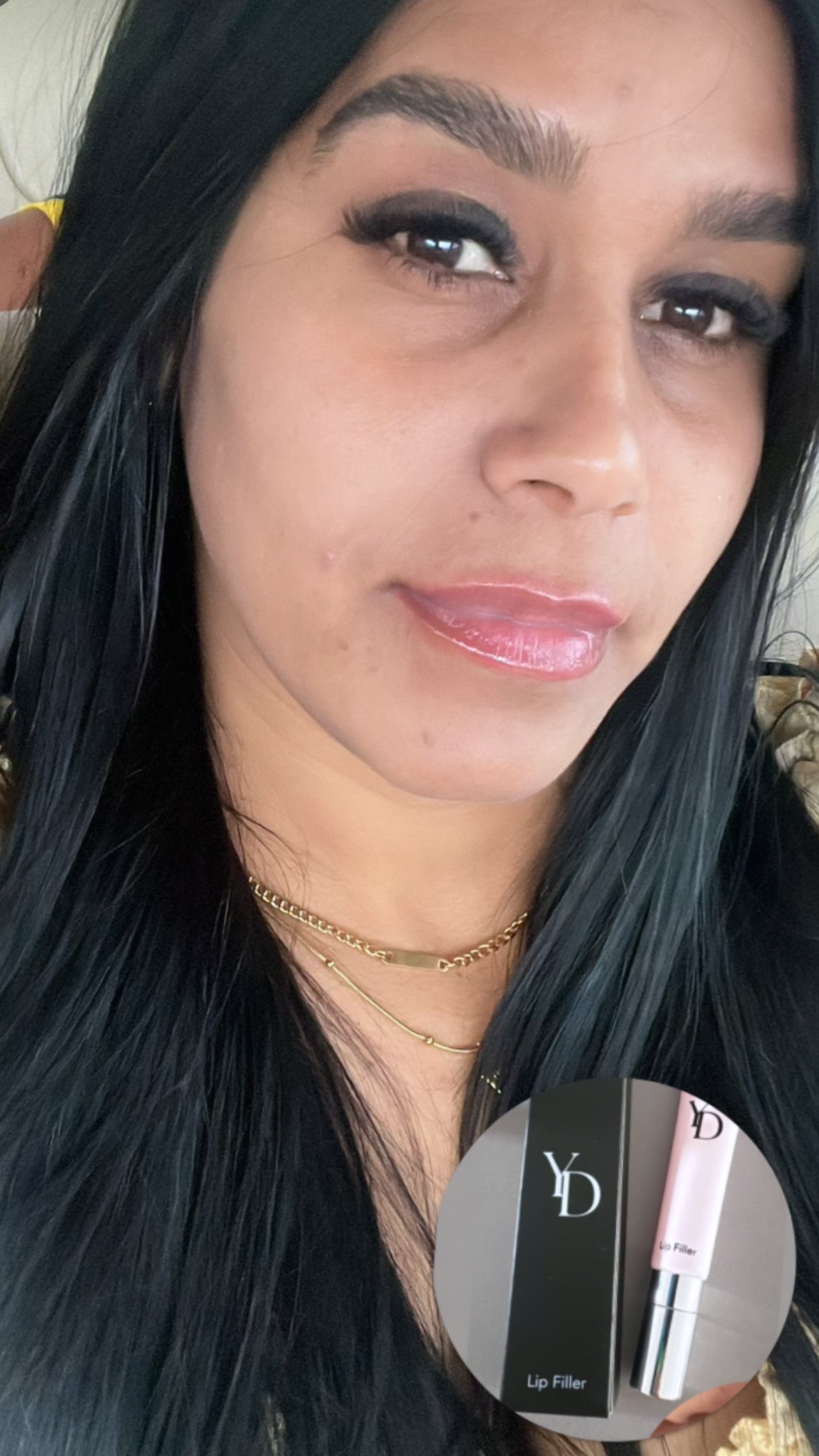 Lip filler level 3 Extremme 🌶️🌶️🌶️